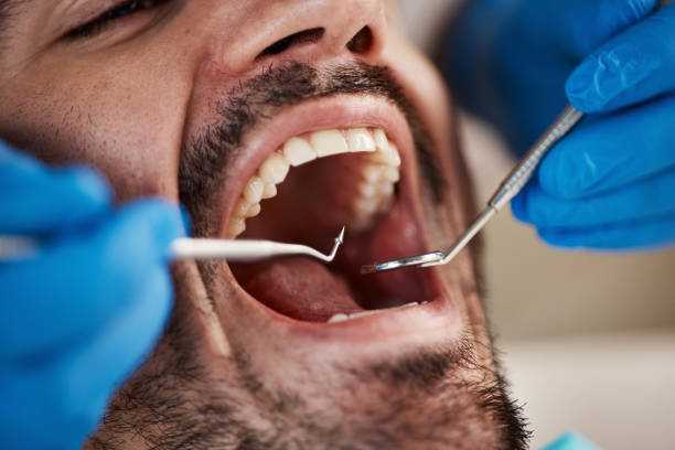 Best Walk-In Emergency Dentist in Primera, TX